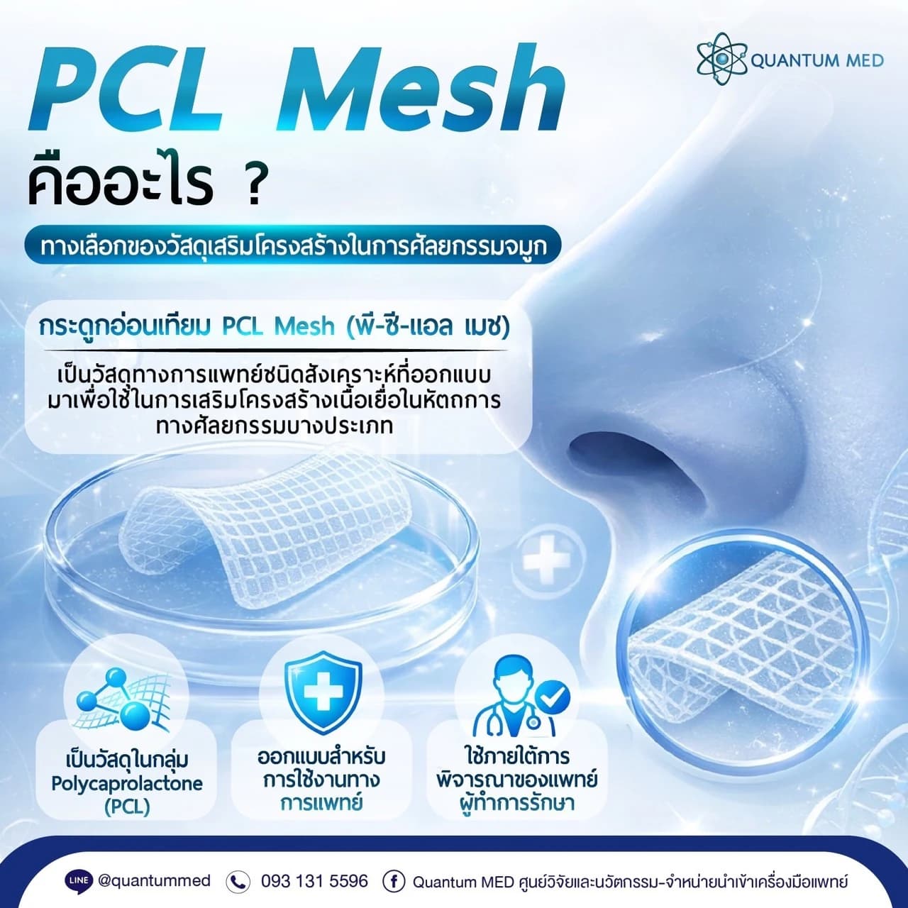 ข้อมูลเกี่ยวกับ PCL Mesh ภาพที่ 2