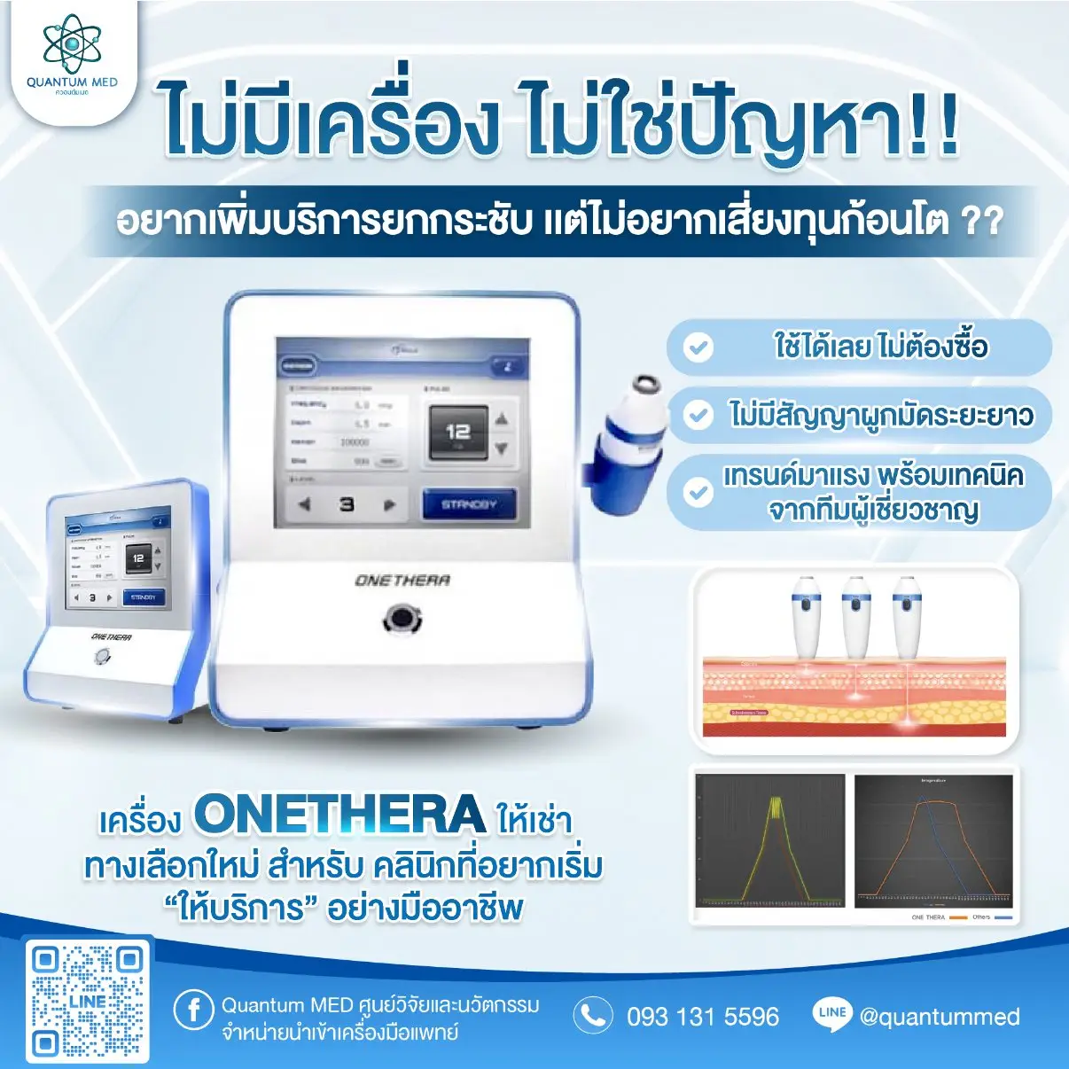 Onethera – การยกกระชับชั้นลึก SMAS และการใช้งานในคลินิก
